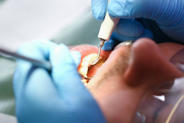 Best Weekend Emergency Dentist in Schulenburg, TX