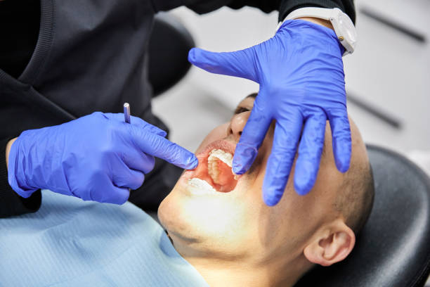 Best Emergency Dental Care for Broken or Chipped Teeth in Schulenburg, TX